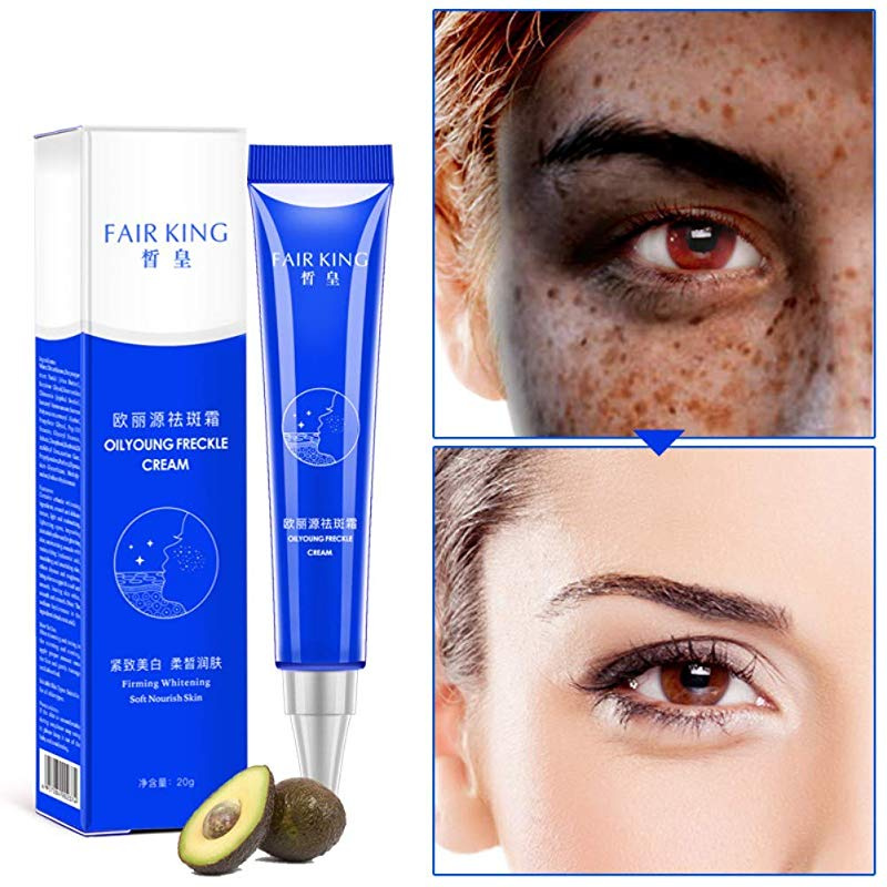 Allbestaye Whitening Cream Face Freckles Removal Cream Dark Spots Cream Against Pigment Spots Age Hyperpigmentation By Allbestaye Shop Online For Beauty In New Zealand