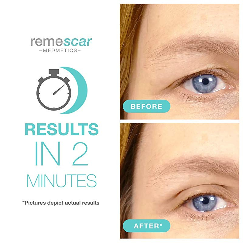 remescar sagging eyelids reviews