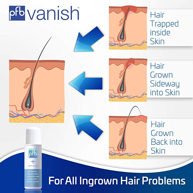 Pfb Vanish Chromabright For Ingrown Hair And Skin Lightening In
